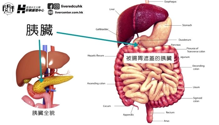 胰臟癌症狀難察覺，預防全賴健康生活 | 香港中文大學-閱肝｜專業健康資訊｜擺脫腸胃肝病