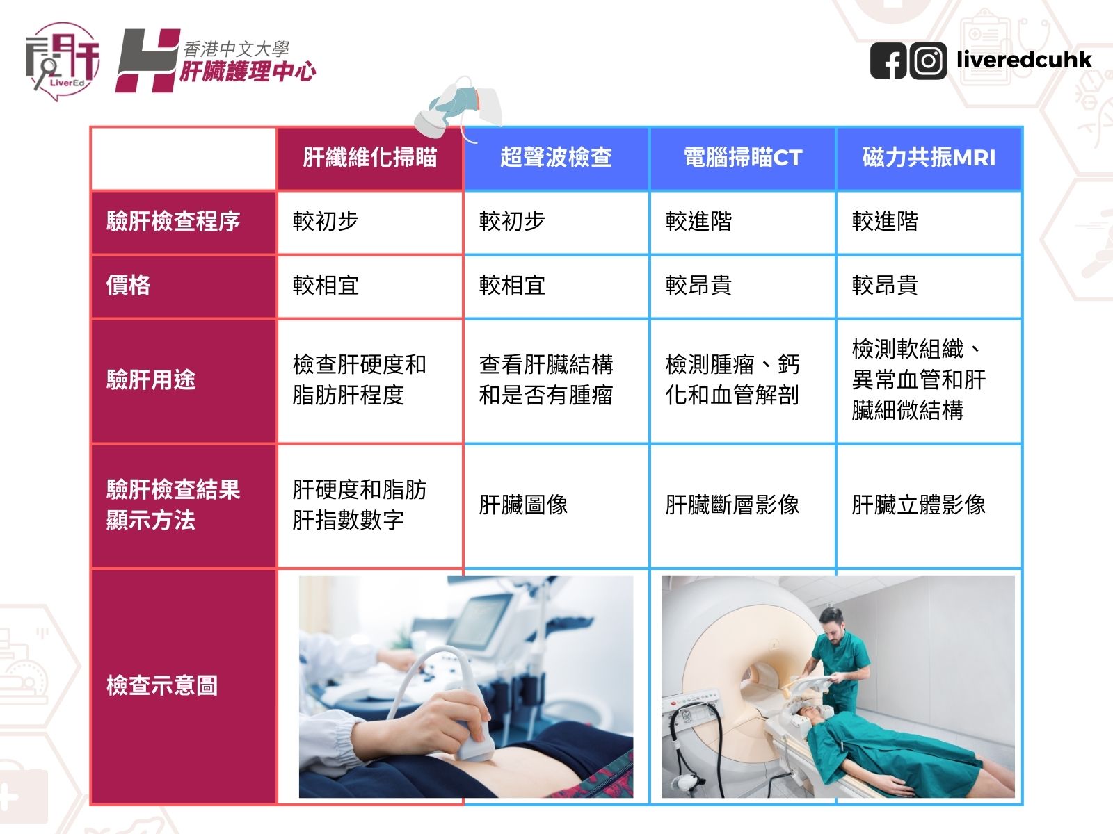 肝纖維化掃瞄、超聲波、電腦掃瞄和磁力共振有甚麼不同？ | 香港中文大學-閱肝｜專業健康資訊｜擺脫腸胃肝病